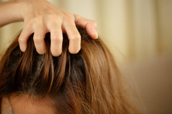 Can Stress Cause Scalp Psoriasis Flare-Ups? Here’s How to Manage Stress and Soothe Your Scalp